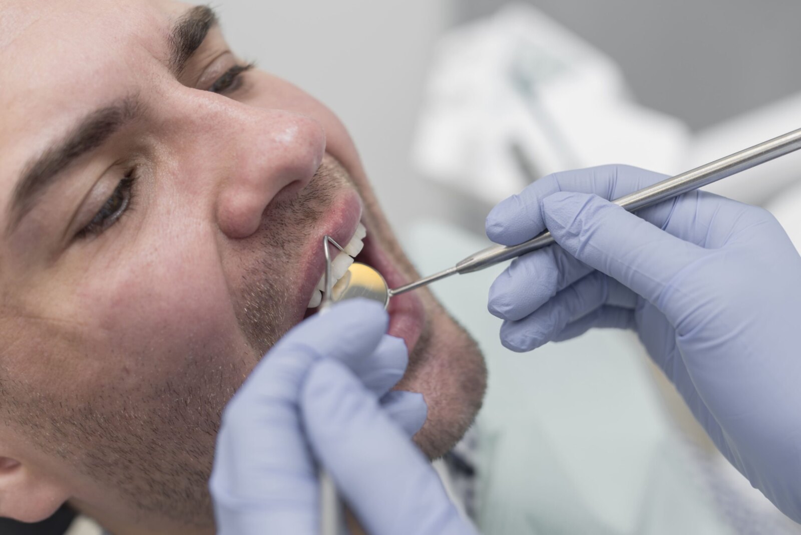 Cirugía Mucogingival: Mejora Estética y Salud Periodontal