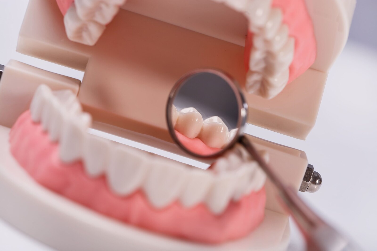 Mantenimiento Dental en Jaén: La Clave para una Sonrisa Saludable