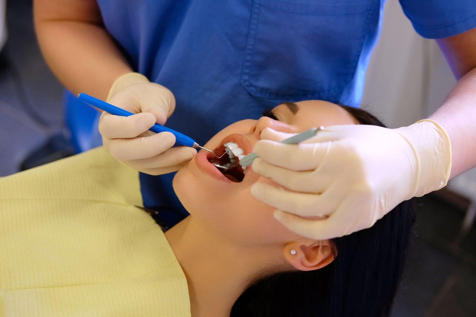 Osteotomía y Exodoncia: Procedimientos Dentales Esenciales