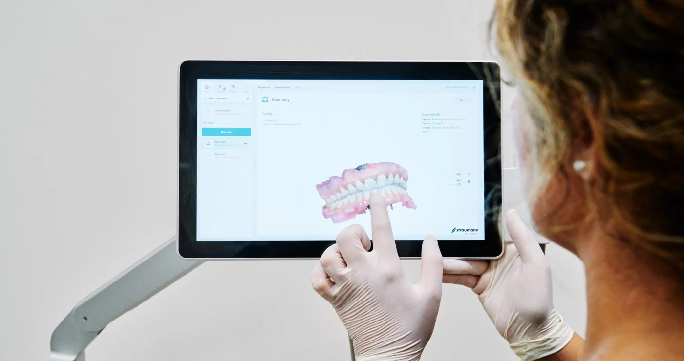 Modelo digital de una boca obtenido con escáner intraoral