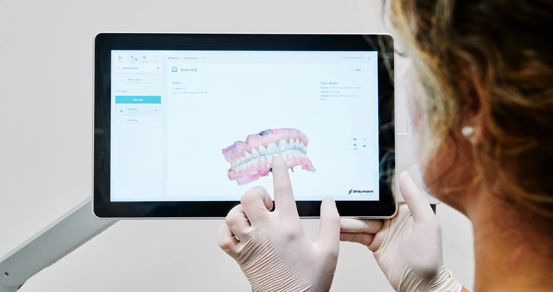 Escaneado intraoral para el diseño de la prótesis