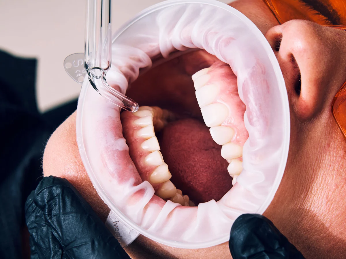 Aplicación de ozonoterapia en Clínica Colodro