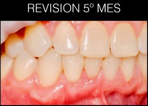 proceso tratamiento 7