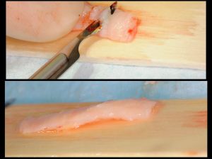 proceso tratamiento 2