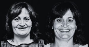 rehabilitacion completa implantes un dia